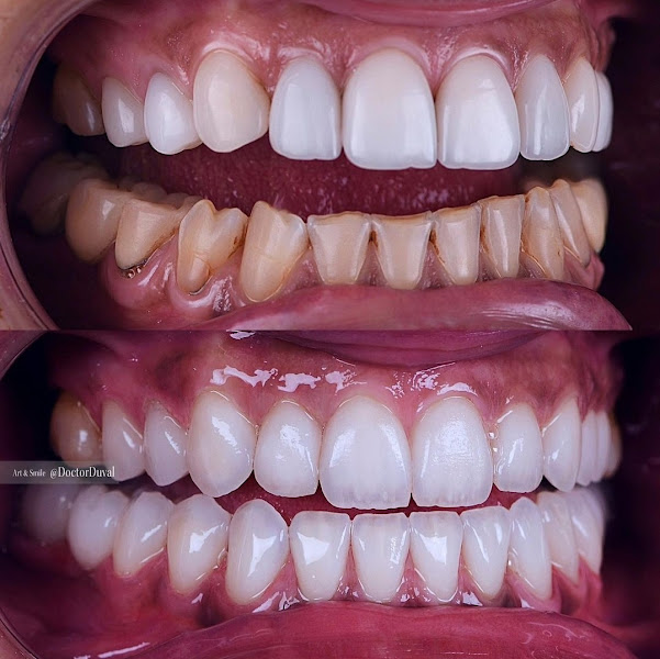 Foto 2 de Dr. Oscar Dias Pimpão | Dentista Curitiba | Implante Dentário Curitiba