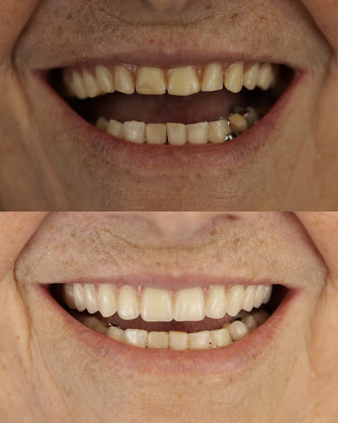 Foto 3 de Dr. Oton Rodrigues | Cirurgião - Dentista em Campina Grande