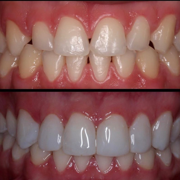 Foto 3 de Dr. Paulo Camurça. Tratamento de Canal - Laser PDT, Implante, Prótese e Estética. Dentista Barra do Ceará, Fortaleza - CE