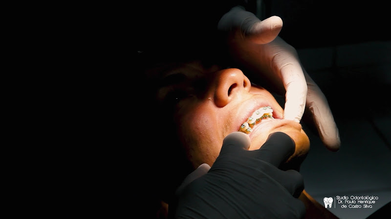 Foto 3 de Dr. Paulo Henrique I Lentes em Resina Praia Grande