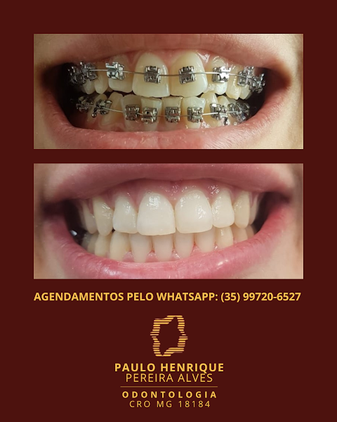 Foto 3 de Dr. Paulo Henrique Pereira Alves | Dentista em Pouso Alegre