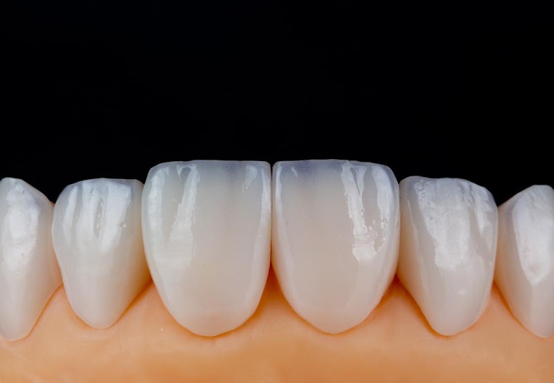 Foto de Dr. Paulo Moreira - Especialista em Lente Dental
