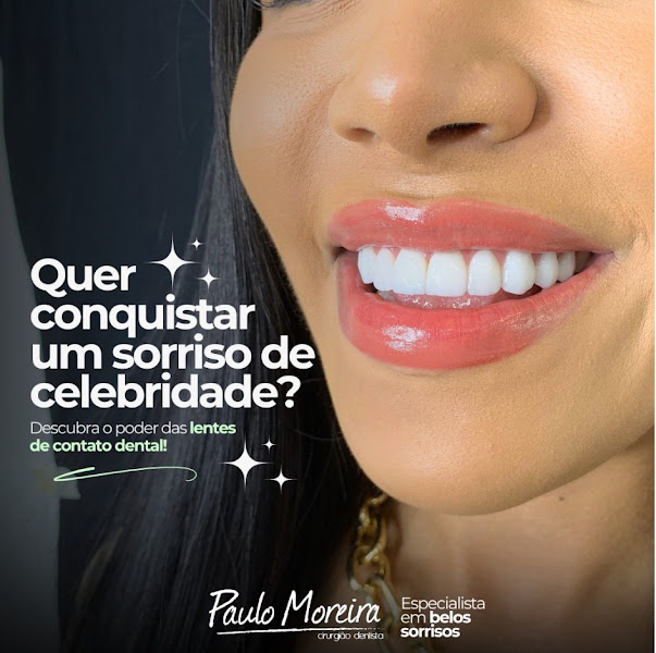 Foto 2 de Dr. Paulo Moreira - Especialista em Lente Dental