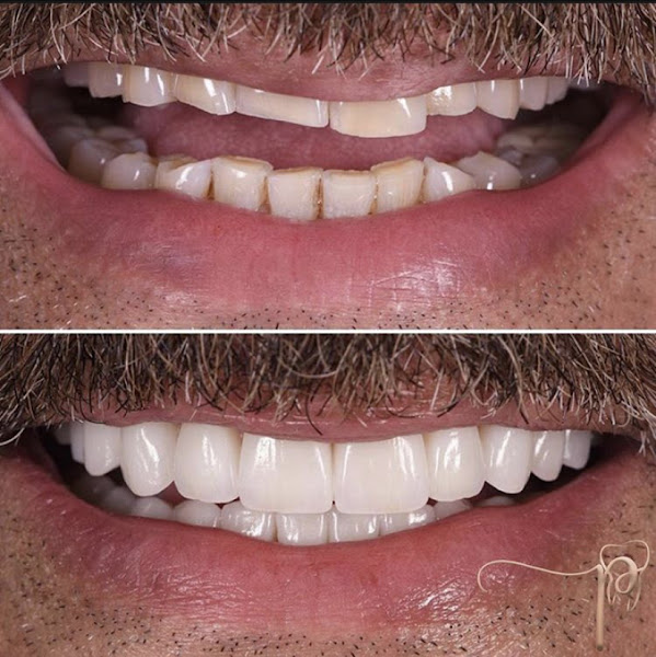 Foto 3 de Dr. Paulo R. Silva Sotolani