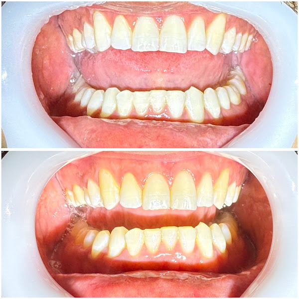 Foto 2 de Dr Paulo Sartori Filho - Endodontista