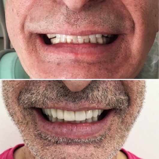 Foto 2 de Dr. Pedro Colli, Dentista