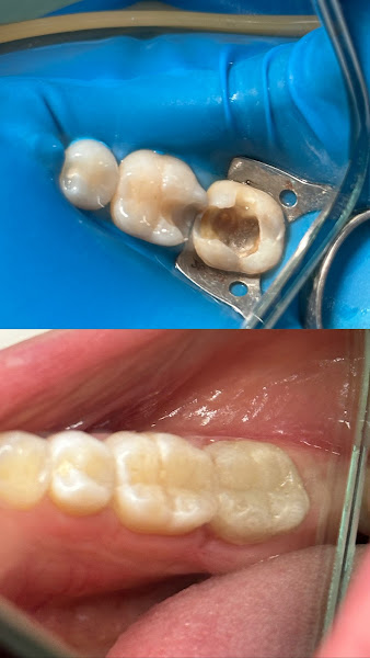 Foto 2 de Dr. Pedro Freitas - Dentista 24h Campina Grande