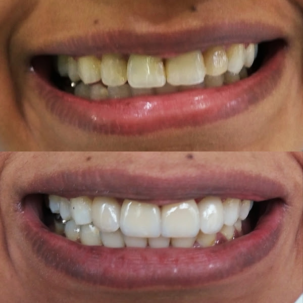 Foto 3 de Dr. Pedro Henrique Arantes