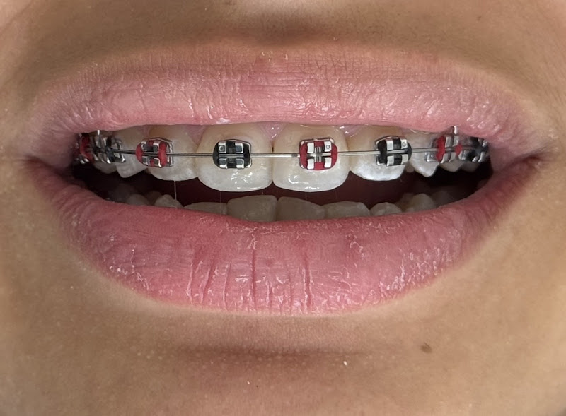 Foto 2 de Dr. Pedro Henrique - Dentista em Jacareí