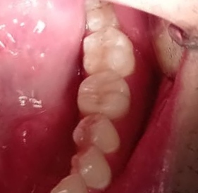 Foto 3 de Dr. Pedro Linares e Dra. Ana Sarti (Clínica Odontológica ISBI).