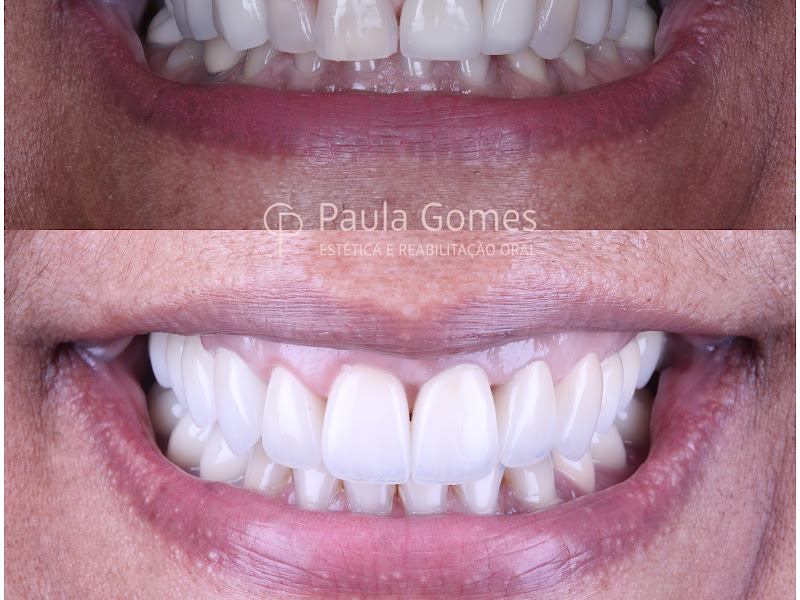 Foto 6 de Dr. Pedro Paulo Aguiar I Harmonização Orofacial