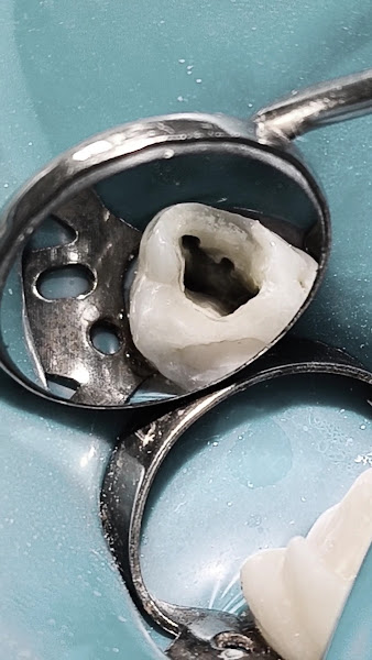 Foto 4 de Dr. Pedro Pinheiro – Dentista 24h Urgências