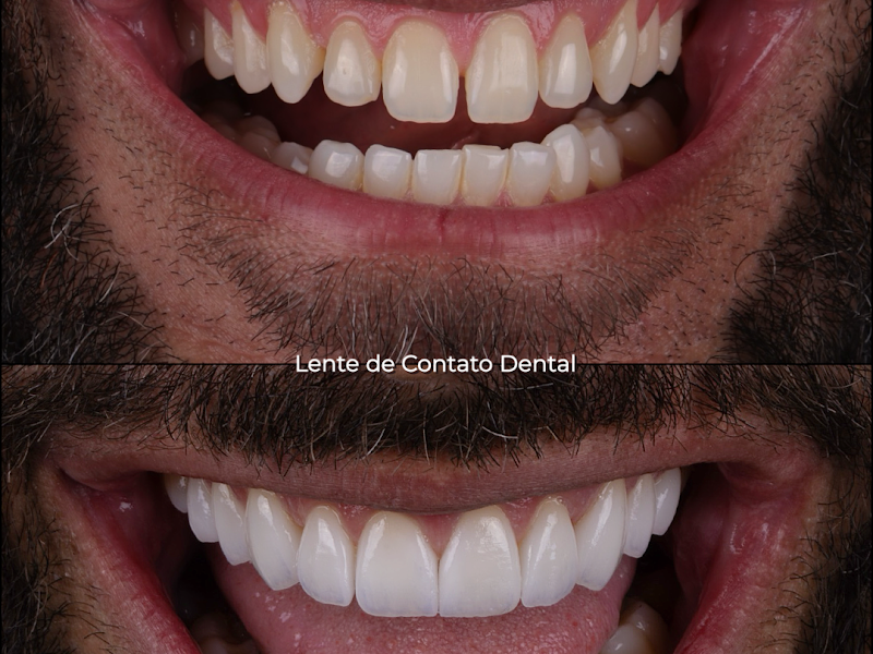 Foto 3 de Dr. Pedro Pontelo - Dentista em BH e Alinhadores Invisíveis