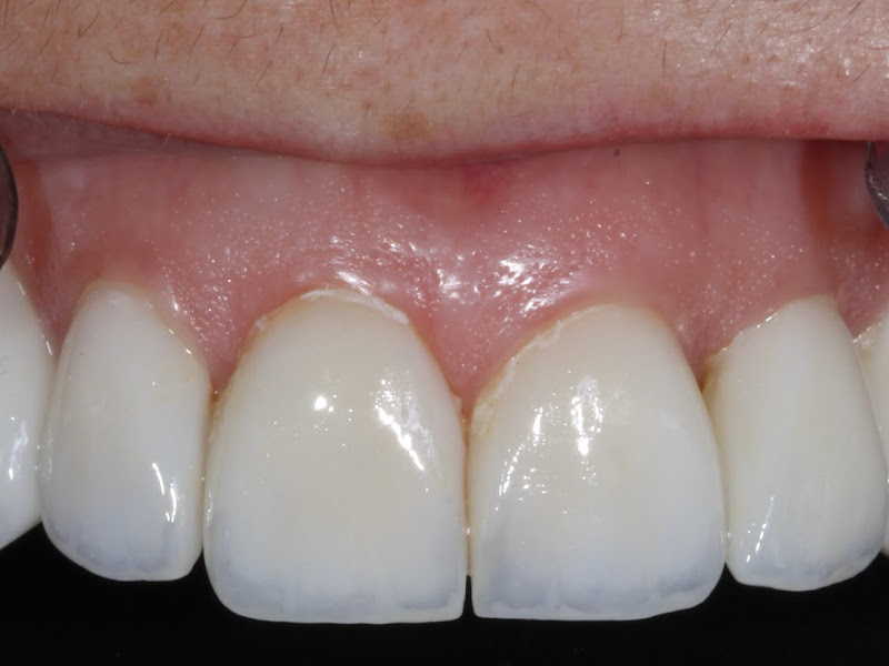 Foto de Dr. Pedro Zulian - Especialista em Reabilitação Oral