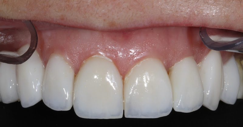 Foto 2 de Dr. Pedro Zulian - Especialista em Reabilitação Oral