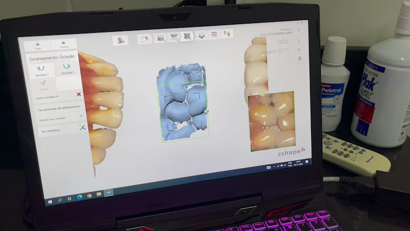 Foto 3 de Dr. Pedro Zulian - Especialista em Reabilitação Oral