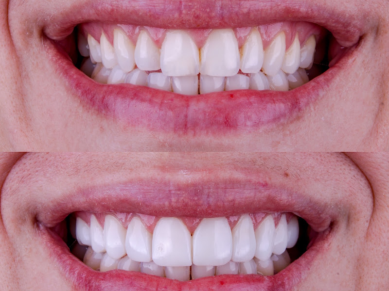 Foto 2 de Dr. Pérsio Nicoletti Cirurgião Dentista