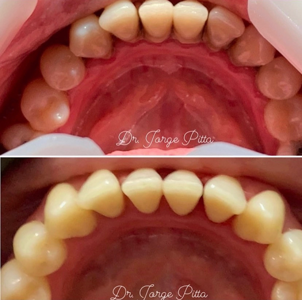 Foto 3 de Dr. Pitta Odontologia - Emergência 24hrs