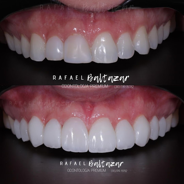 Foto 3 de Dr. Rafael Baltazar Marcos - Dentista em Guarapuava