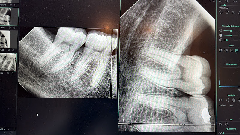Foto 3 de Dr. Rafael Morales – Dentista | CHEGA DE DOR DE DENTE | Urgência 24 h - SINOP
