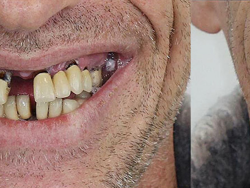 Foto 2 de Dr. Rafael Neiva - Implantes Dentários