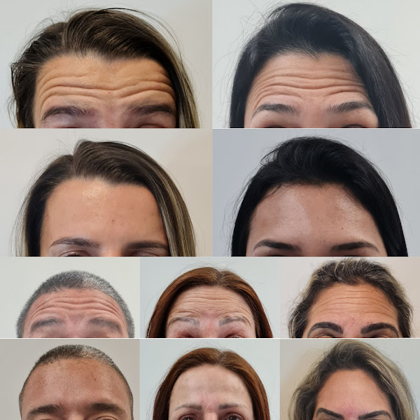 Foto 3 de Dr. Rafael Primo - Harmonização Facial e Cirurgia Estética Facial