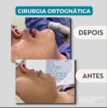 Foto 3 de Dr. Rafael Rodrigo Faccio - Cirurgia Buco Maxilo Facial /Ortognática / Implantes/Zigomático / Cirurgia de ATM