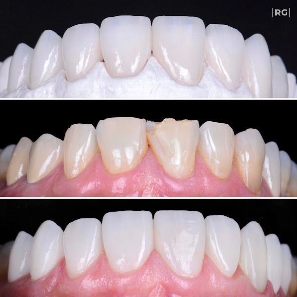 Foto 3 de Dr. Raí Gomes - Implantodontia & Estética