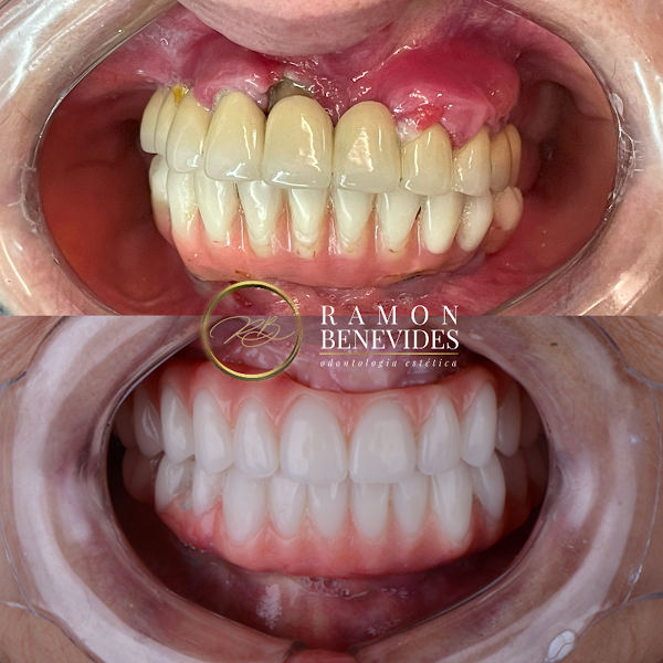 Foto 2 de Dr Ramon Benevides