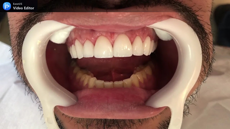 Foto 3 de Dr Ramon Benevides