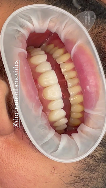 Foto 4 de Dr Ramon Benevides