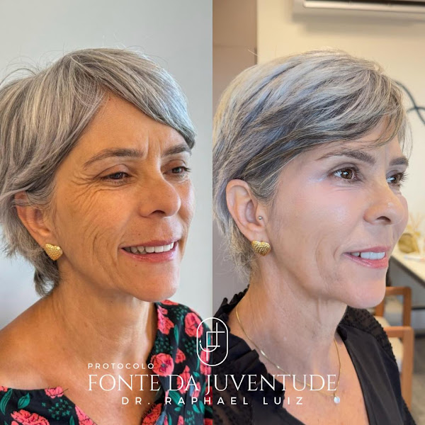 Foto 2 de Dr. Raphael Luiz | Harmonização Facial em São José dos Campos