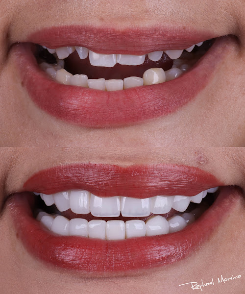 Foto 3 de Dr. Raphael Moreira - Dentista