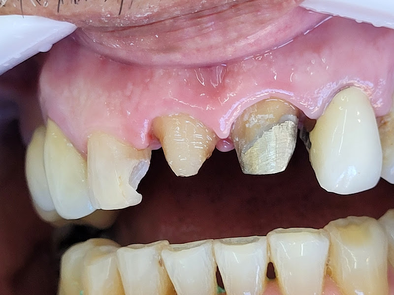 Foto 5 de Dr. Regina Bruhn de Castro - Dentista