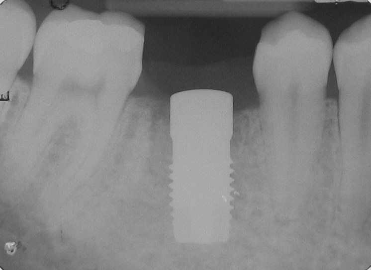 Foto 3 de Dr. Renã Miranda Cordeiro (Cordeiro Reabilitação Oral)