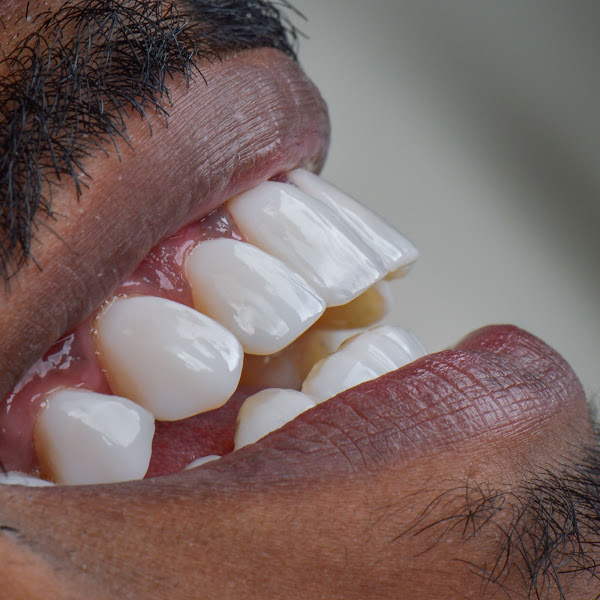 Foto 3 de Dr.Renan Chierici