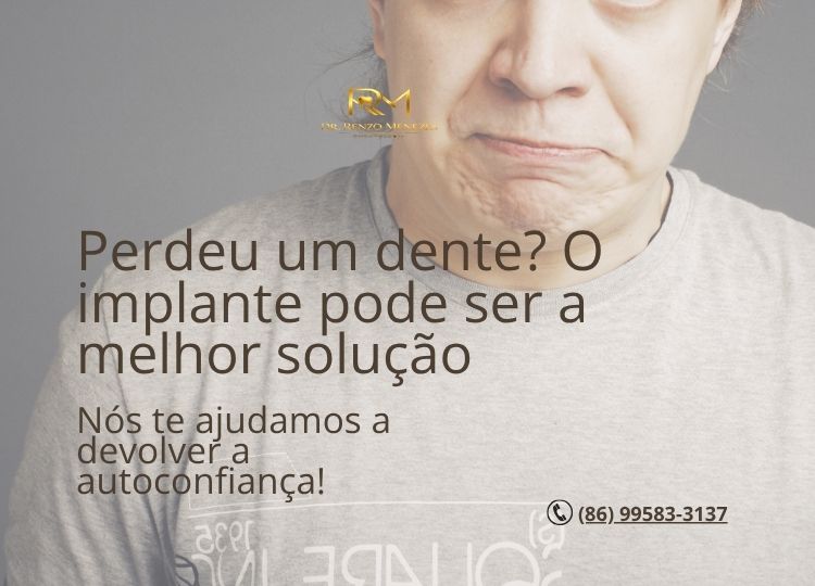 Foto 3 de Dr. Renzo Menezes | Invisalign e Implantes Dentários em Teresina