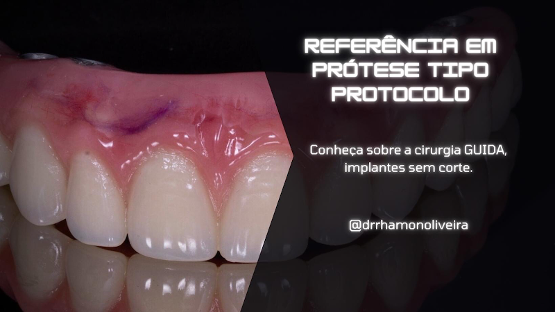 Foto 2 de Dr Rhamon Oliveira Implante Dentário Serra