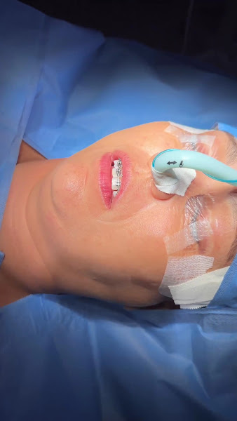 Foto 2 de Dr. Ricardo De Biase - Bucomaxilo em Recife - Bucomaxilofacial - Implante Dentário - Cirurgia Ortognática - Protese Protocolo