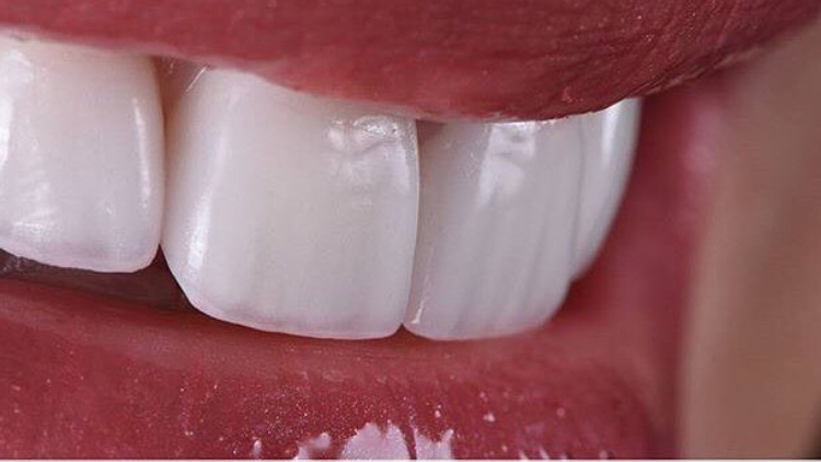 Foto 2 de Dr. Ricardo Lippo | Dentista em Recife | Implantes dentários