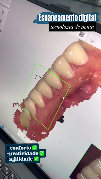Foto 4 de Dr. Ricardo Lippo | Dentista em Recife | Implantes dentários