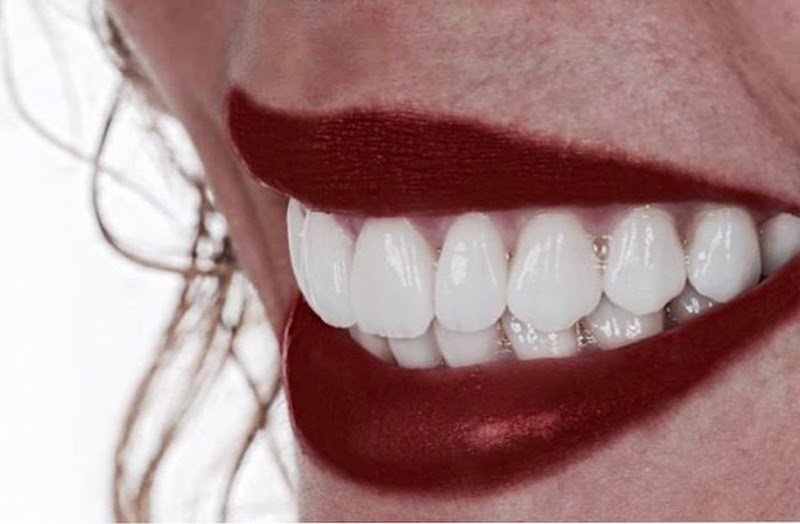 Foto 5 de Dr. Ricardo Lippo | Dentista em Recife | Implantes dentários