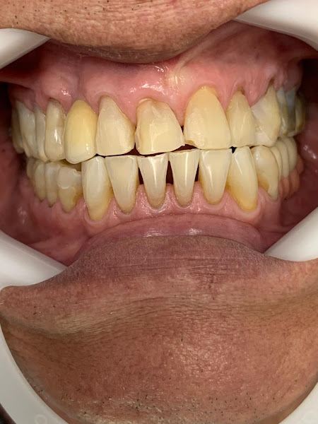 Foto 2 de Dr. Ricardo Mello l Dentista em Contagem l Implantes - Clareamento Dental - Facetas