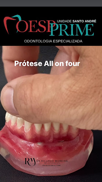 Foto 2 de Dr Ricardo Moreira | Dentista | Santo Andre/SP | Implantes Dentários | Aparelho Invisível | Sousmile | Invisalign