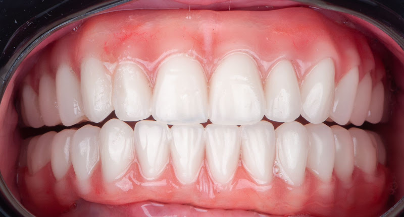 Foto 2 de Dr. Ricardo Senko - Implantes Dentários & Cirurgia Bucomaxilofacial