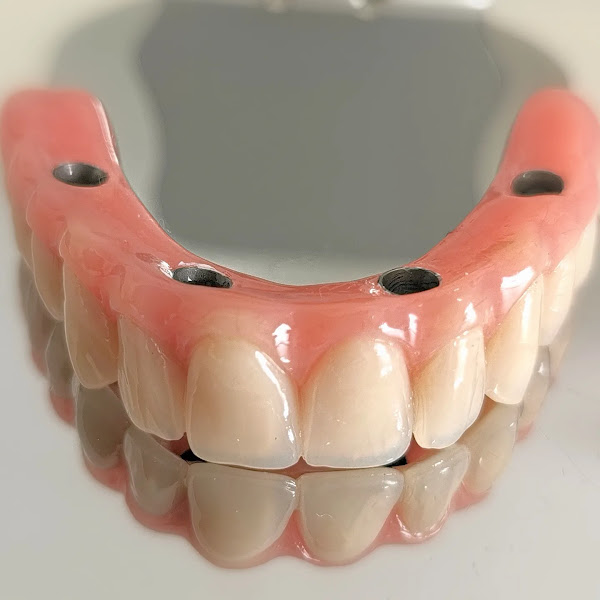 Foto 3 de Dr. Richard Menegassi - Especialista em Implantes Dentários