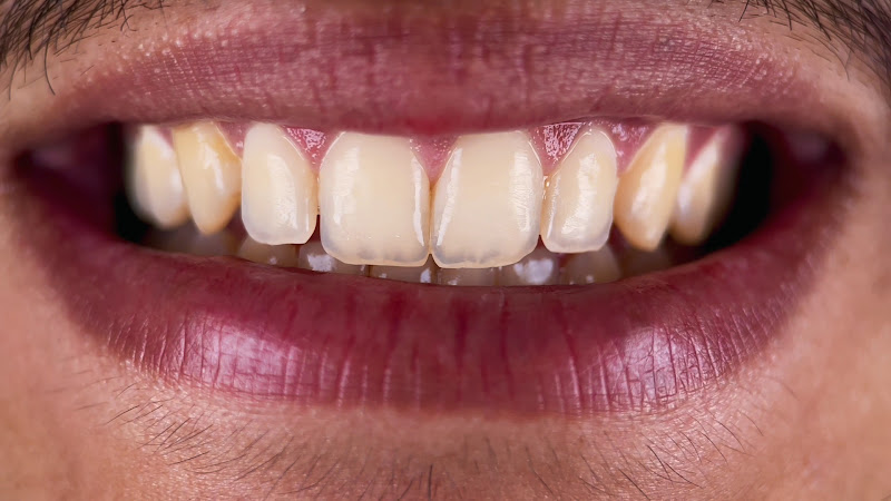 Foto 3 de Dr. Roberto Félix - Odontologia Estética e Funcional