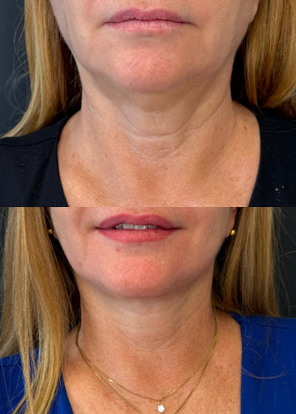 Foto 3 de Dr. Robson Andrade - Cirurgias Estéticas da Face e Harmonização Facial