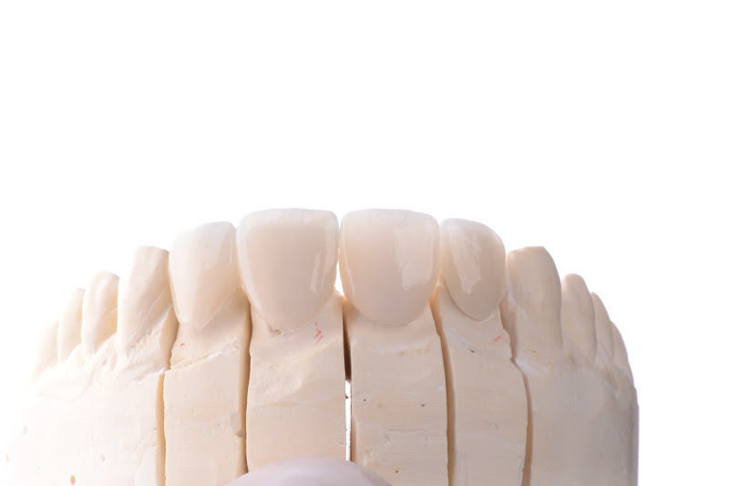 Foto 2 de Dr. Robson Ribeiro - Implantes e Prótese Dentária