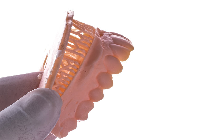 Foto 3 de Dr. Robson Ribeiro - Implantes e Prótese Dentária